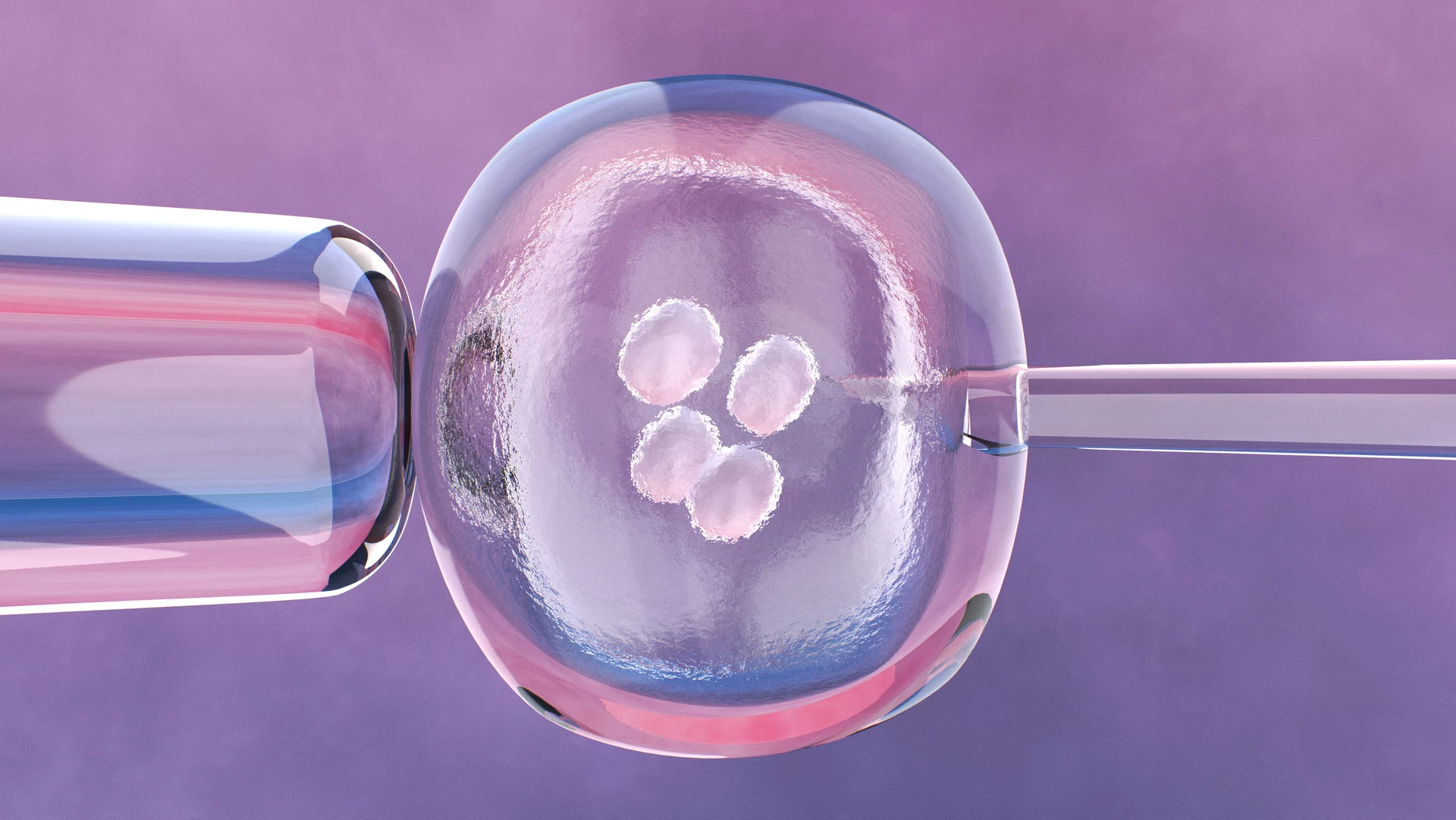 why ivf is costly